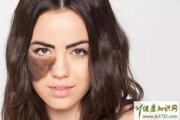 额头胎记算命有哪些影响-