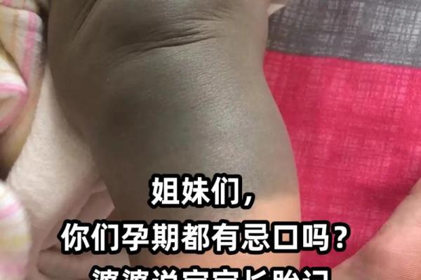 大腿上胎记的位置与算命 大腿上胎记的位置与算命