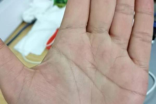 算命的说，手腕上有这样的纹路，一定会破财！
