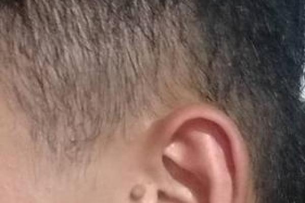 后脑勺有三条竖杠 后脑勺头皮三条竖纹算命