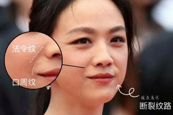 八字纹,八字纹是什么样子图片