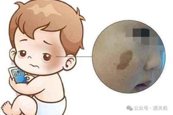 腰部上的胎记如何算命分析？