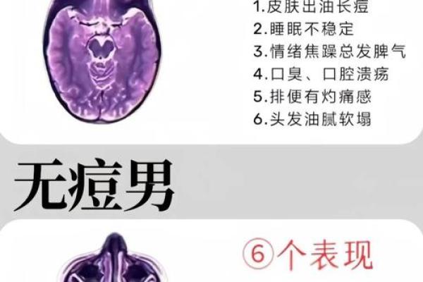 长痘风水学
