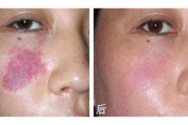 胎记算命图,后背胎记全面图解