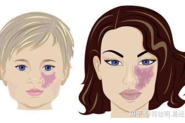 风水学上胎记中的有说明什么